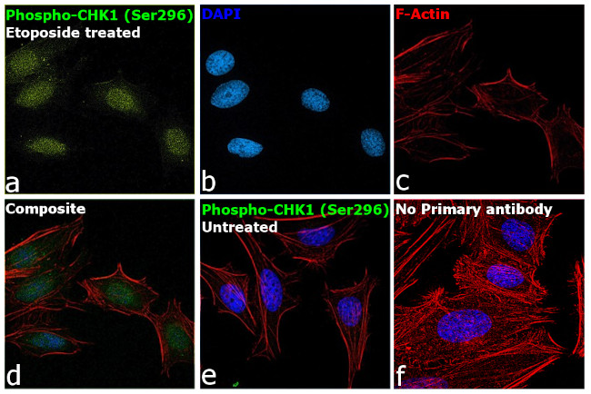 Phospho-CHK1 (Ser296) Antibody in Immunocytochemistry (ICC/IF)