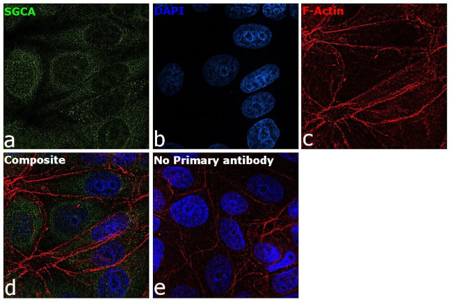 Alpha Sarcoglycan Antibody in Immunocytochemistry (ICC/IF)