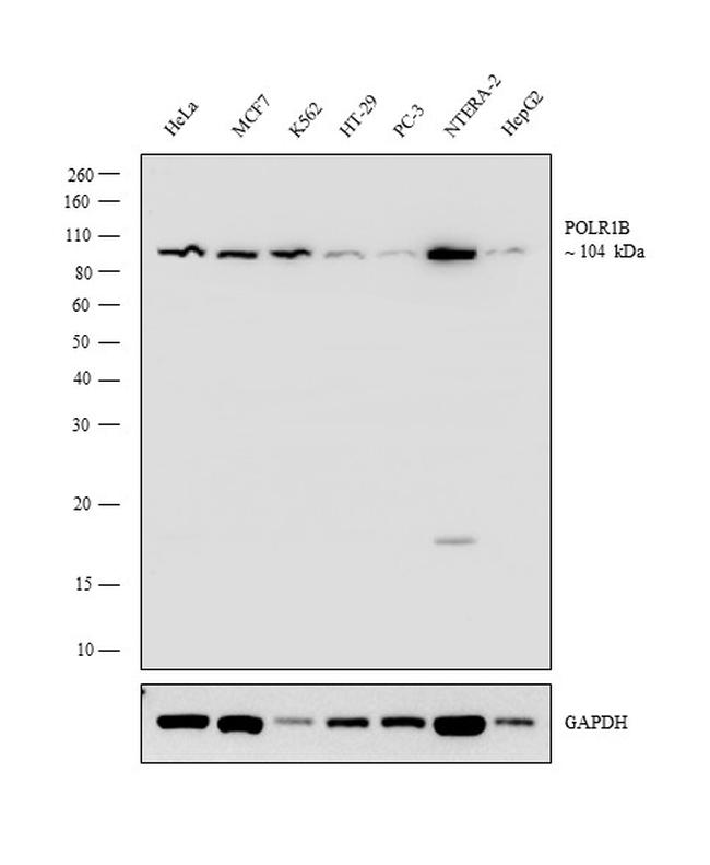 POLR1B Antibody in Western Blot (WB)