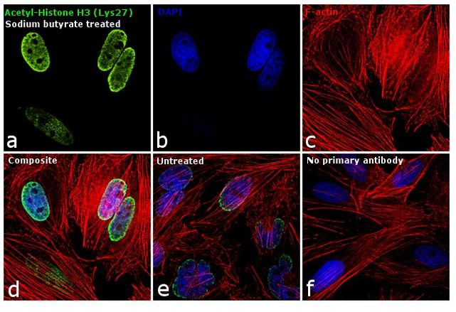 H3K27ac Antibody in Immunocytochemistry (ICC/IF)
