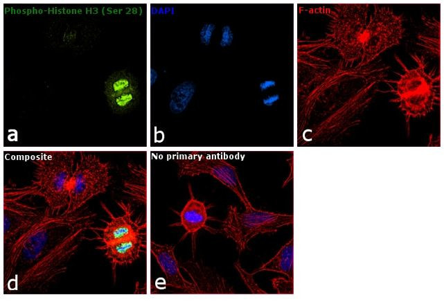 Phospho-Histone H3 (Ser28) Antibody in Immunocytochemistry (ICC/IF)