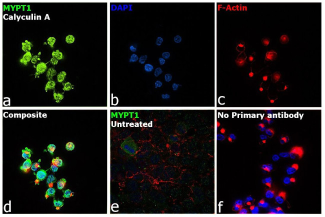 Phospho-MYPT1 (Thr853) Antibody in Immunocytochemistry (ICC/IF)