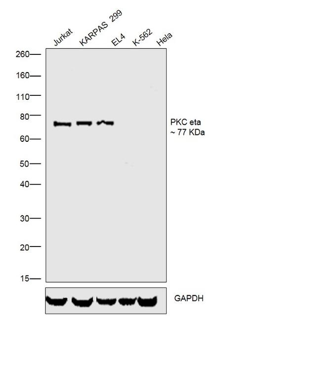 PKC eta Antibody in Western Blot (WB)