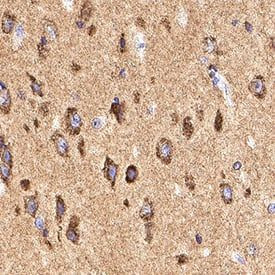 NPTXR Antibody in Immunohistochemistry (Paraffin) (IHC (P))