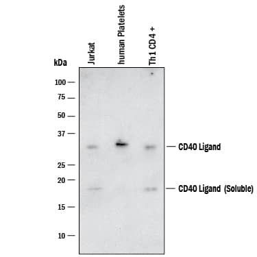 CD154 (CD40 Ligand) Antibody in Western Blot (WB)