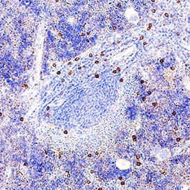 NKp46 Antibody in Immunohistochemistry (Paraffin) (IHC (P))