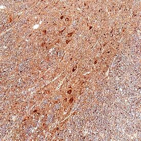 Spinesin Antibody in Immunohistochemistry (Paraffin) (IHC (P))