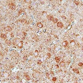 UNC5B Antibody in Immunohistochemistry (Paraffin) (IHC (P))