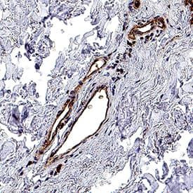 IL1RAPL2 Antibody in Immunohistochemistry (Paraffin) (IHC (P))