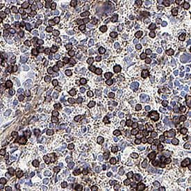 IL17RB Antibody in Immunohistochemistry (Paraffin) (IHC (P))