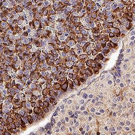 Prolactin Antibody in Immunohistochemistry (Paraffin) (IHC (P))