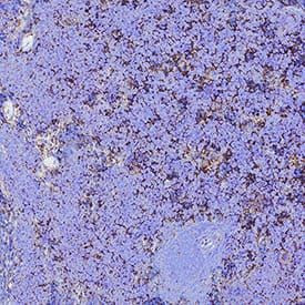 CD47 Antibody in Immunohistochemistry (Paraffin) (IHC (P))