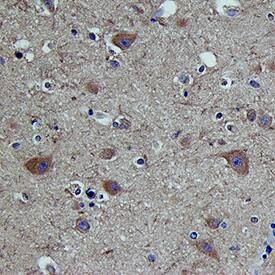 SEMA6B Antibody in Immunohistochemistry (Paraffin) (IHC (P))