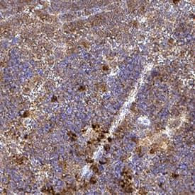 CD223 Antibody in Immunohistochemistry (Paraffin) (IHC (P))