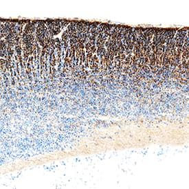 GAS1 Antibody in Immunohistochemistry (Paraffin) (IHC (P))