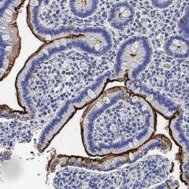 MEP1B Antibody in Immunohistochemistry (Paraffin) (IHC (P))
