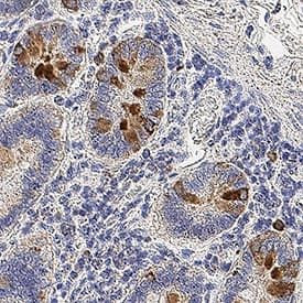 Kallikrein 12 Antibody in Immunohistochemistry (Paraffin) (IHC (P))