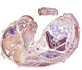 SLIT3 Antibody in Immunohistochemistry (Paraffin) (IHC (P))