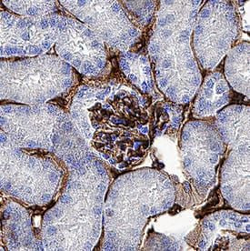 Thrombomodulin Antibody in Immunohistochemistry (Paraffin) (IHC (P))