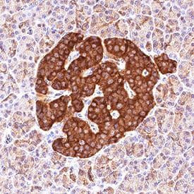 ICA1 Antibody in Immunohistochemistry (Paraffin) (IHC (P))