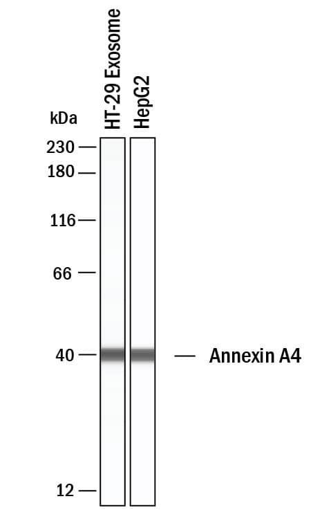 Annexin A4 Antibody in Western Blot (WB)