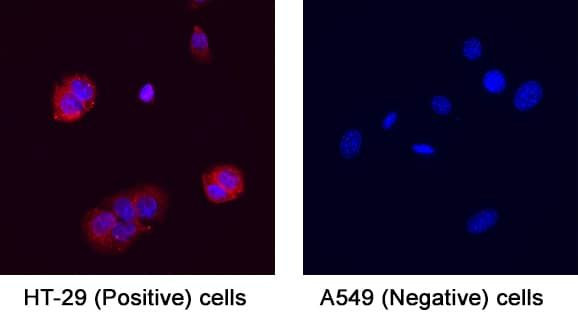 ITGB6 Antibody in Immunocytochemistry (ICC/IF)