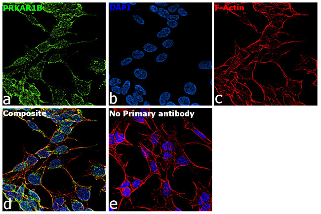 PRKAR1B Antibody in Immunocytochemistry (ICC/IF)