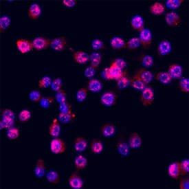 ITLN1 Antibody in Immunocytochemistry (ICC/IF)