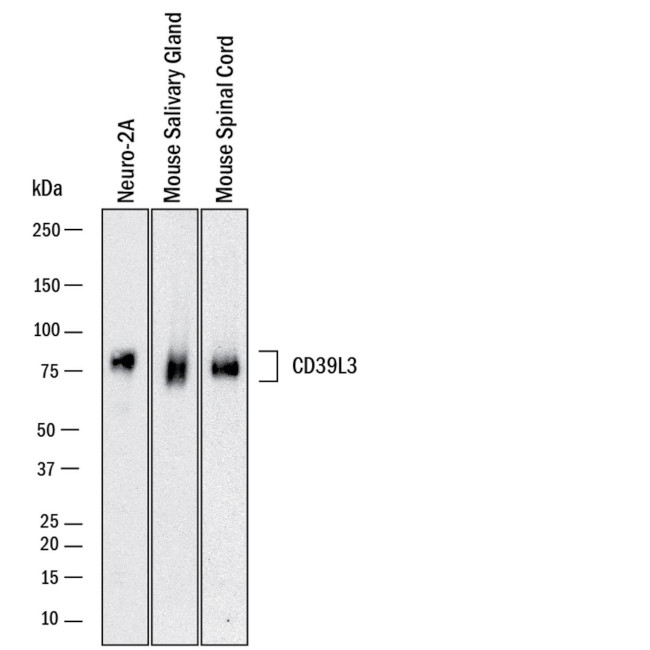 ENTPD3 Antibody in Western Blot (WB)
