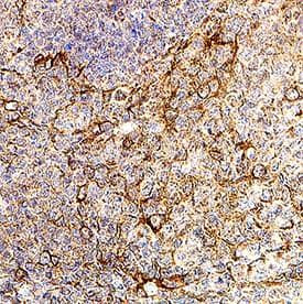 Ninjurin 2 Antibody in Immunohistochemistry (Paraffin) (IHC (P))