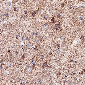 TIMP1 Antibody in Immunohistochemistry (Paraffin) (IHC (P))