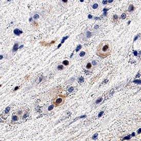 ASCL2 Antibody in Immunohistochemistry (Paraffin) (IHC (P))