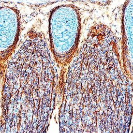 PLXNB2 Antibody in Immunohistochemistry (Paraffin) (IHC (P))