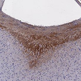 DCC Antibody in Immunohistochemistry (Paraffin) (IHC (P))