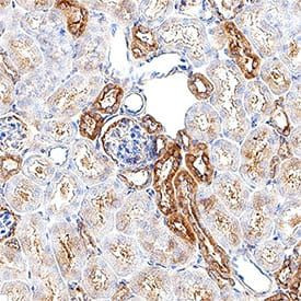 ADAM9 Antibody in Immunohistochemistry (Paraffin) (IHC (P))