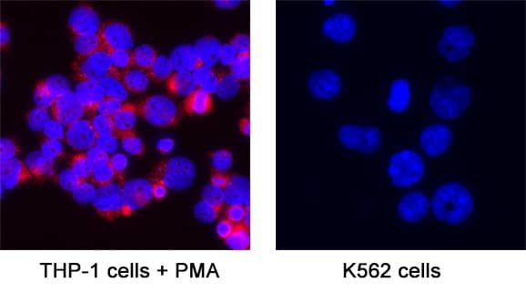 TSLP Receptor Antibody in Immunocytochemistry (ICC/IF)