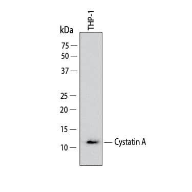 Cystatin A Antibody in Western Blot (WB)