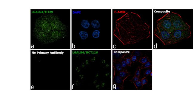 Galectin 4 Antibody in Immunocytochemistry (ICC/IF)