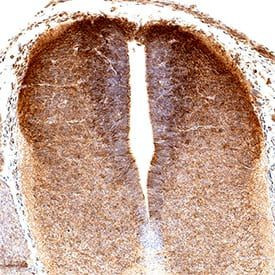 IGFBPL1 Antibody in Immunohistochemistry (Paraffin) (IHC (P))