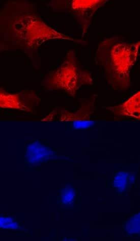 FUT11 Antibody in Immunocytochemistry (ICC/IF)