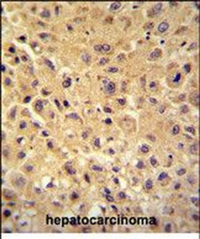 WBSCR27 Antibody in Immunohistochemistry (Paraffin) (IHC (P))