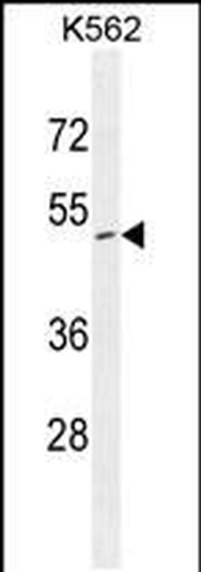 ZNF517 Antibody in Western Blot (WB)