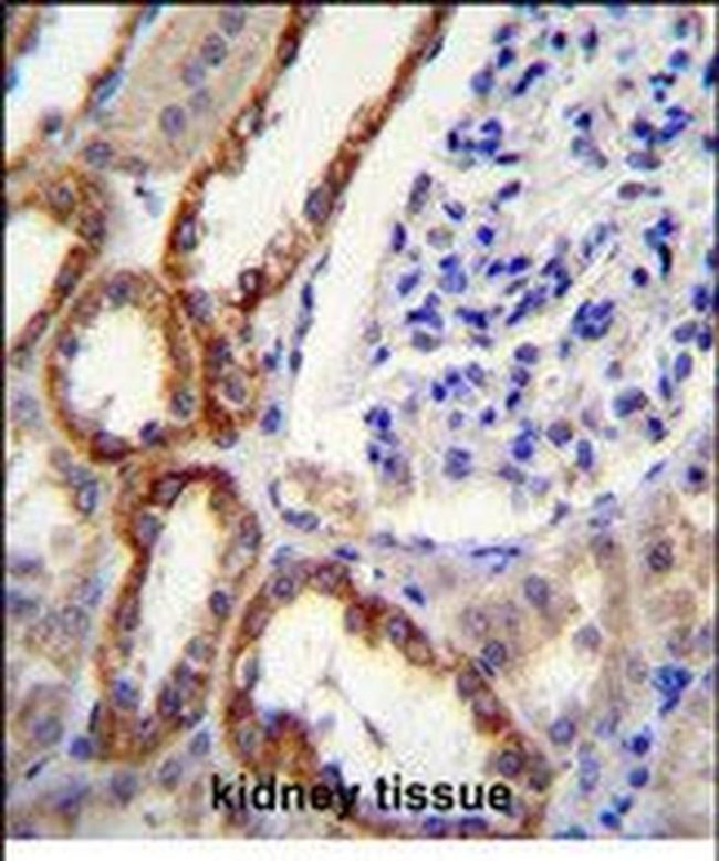 PARS2 Antibody in Immunohistochemistry (Paraffin) (IHC (P))