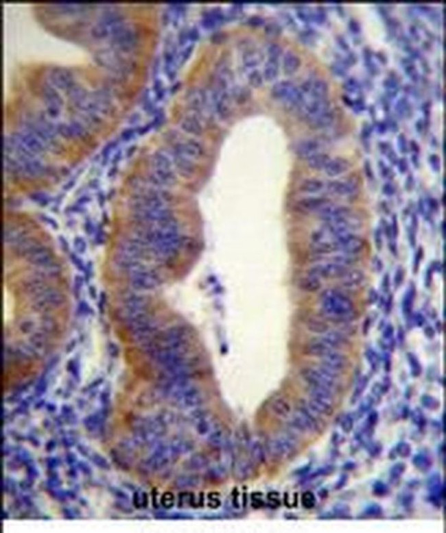 FGD6 Antibody in Immunohistochemistry (Paraffin) (IHC (P))