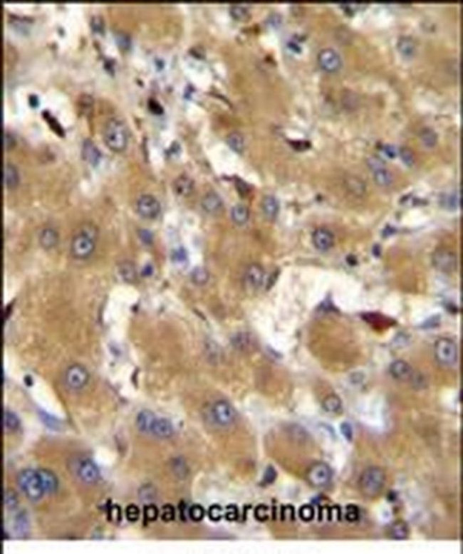 HPR Antibody in Immunohistochemistry (Paraffin) (IHC (P))