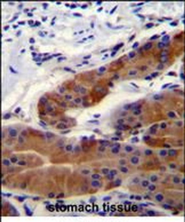 DFNB31 Antibody in Immunohistochemistry (Paraffin) (IHC (P))