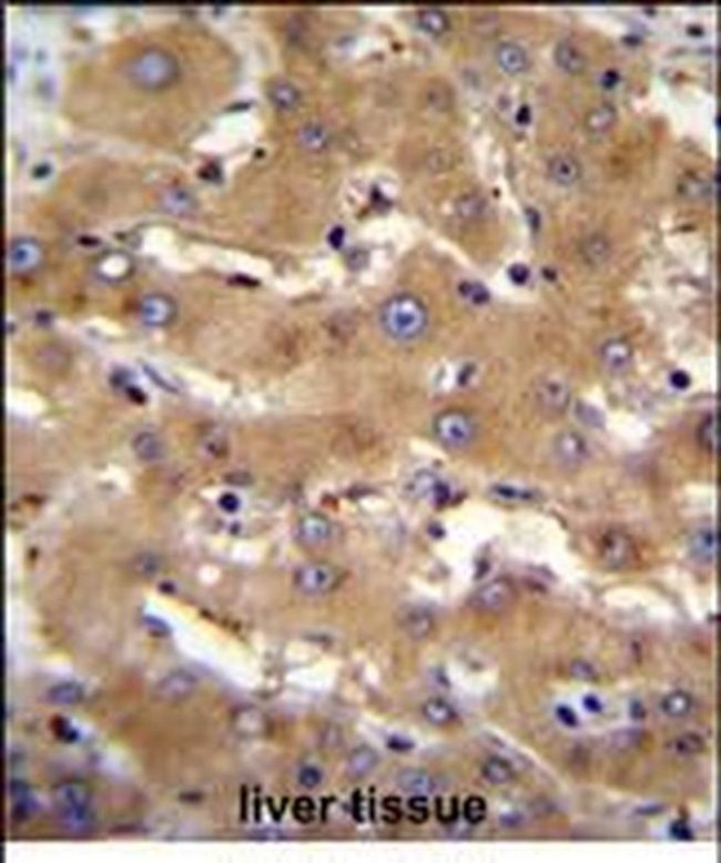 PHF12 Antibody in Immunohistochemistry (Paraffin) (IHC (P))