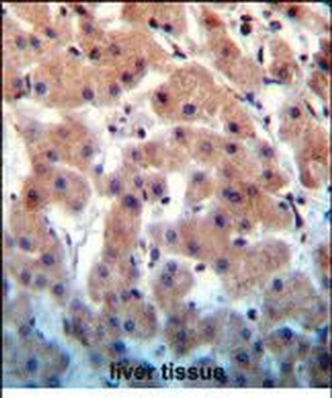 INHBB Antibody in Immunohistochemistry (Paraffin) (IHC (P))