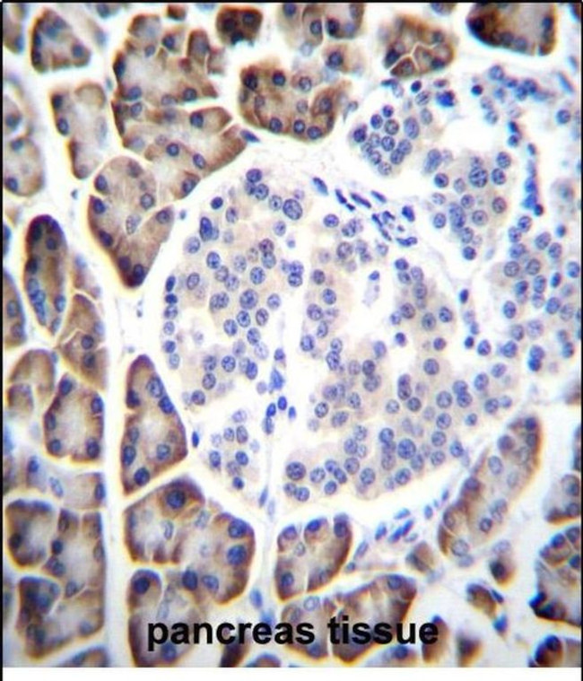 UROC1 Antibody in Immunohistochemistry (Paraffin) (IHC (P))