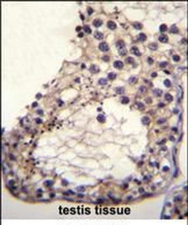 OTOA Antibody in Immunohistochemistry (Paraffin) (IHC (P))